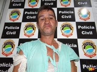 Celio Novaes também sofreu queimaduras, mas foi preso em flagrante por provocar incêndio (Foto: Sidney Bronka/94 FM)