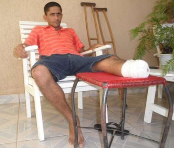 Homem que perdeu parte da perna acusa hospital de neglig&ecirc;ncia