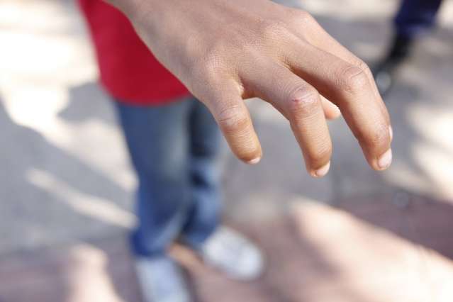 Aluno de 13 anos &eacute; mordido por rato dentro de escola em Campo Grande