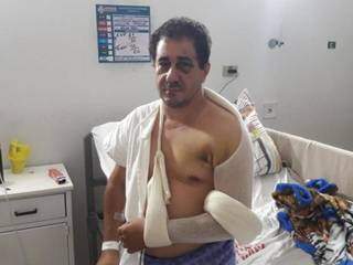 Anderson Pereira Rocha aguarda por cirurgia após sofrer acidente com bicicleta elétrica (Foto: Arquivo Pessoal)