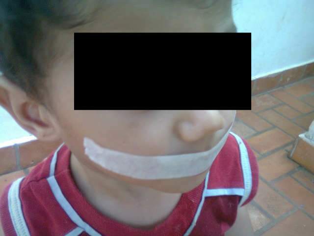  Funcion&aacute;ria de creche particular do S&atilde;o Bento &eacute; suspeita de maltratar crian&ccedil;as