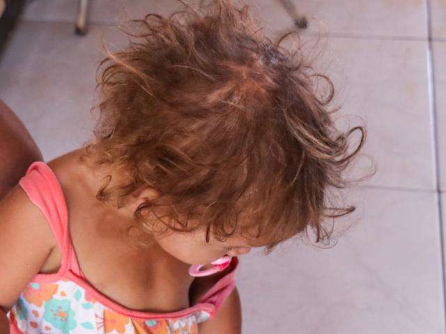 Secretaria alega que beb&ecirc; est&aacute; sem ajuda para tratamento porque n&atilde;o acha fam&iacute;lia