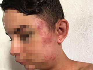 Adolescente é espancado por grupo de 5 jovens e celular some Adolescente é espancado por grupo de 5 jovens e celular some