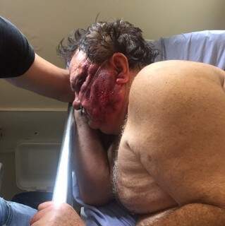 Foto divulgada em grupo de WattsApp mostra Benê Cantelli com o rosto desfigurado (Foto: Divulgação)