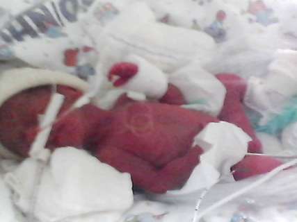 Bebê que “ressuscitou” após 5 horas foi considerado feto inviável, diz HU