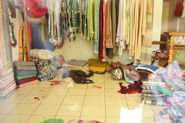 Mulher ferida por ex-marido que cometeu suic&iacute;dio segue com bala alojada no rosto