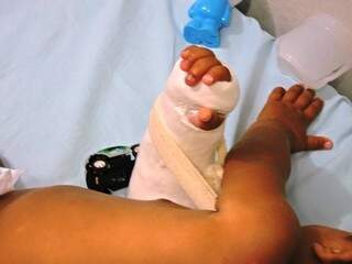 Menino chegou ao hospital com braço quebrado e marcas de queimadura. (Foto: Rádio Caçula)