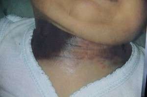 Pol&iacute;cia pede lista de m&eacute;dicos que atenderam beb&ecirc; com hemofilia