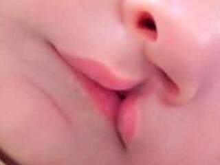 Má-formação cria fenda no lábio e palato, que depende de cirurgia para ser corrigida. (Foto: Secom-PB/Reprodução)