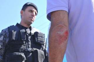 Funcionário público entrou em luta com assaltante e ficou ferido, mas tiro atingiu o chão (Foto: Alcides Neto)