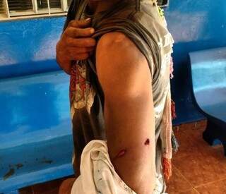 Índio com ferimento no braço; eles acusam fazendeiros pelo ataque (Foto: Divulgação/Cimi)
