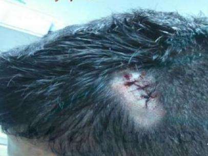 Policiais militares s&atilde;o atingidos por garrafas durante abordagem