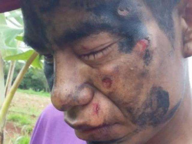 Pol&iacute;cia Federal visita acampamento ind&iacute;gena para investigar ataque 