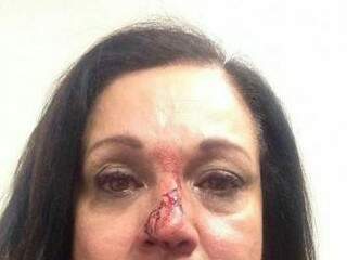 Foto foi tirada logo após vítima ser agredida. Ela foi à polícia registrar o caso (Foto: Reprodução Facebook)