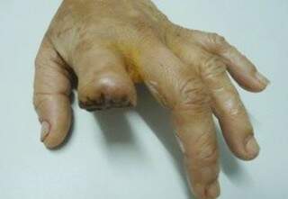 A mulher que foi acusada de furto, teve o dedo decepado por Ana Popó. (Foto: Perfil News)