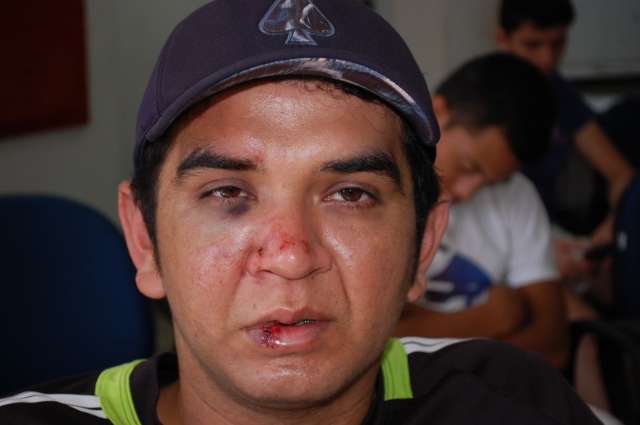 Homem vai &agrave; pol&iacute;cia e diz que foi agredido por guarda municipal