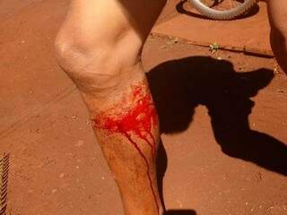 Índio mostra ferimento na perna, que teria sido provocado por tiro disparado por seguranças (Foto: Direto das Ruas)