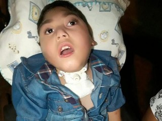Luiz Francisco Lima da Silva Junior usava a traqueostomia desde que nasceu (Foto: Arquivo Pessoal)