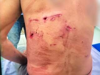 Ferimentos nas costas de Ramão provocados pelo animal. (Foto: Divulgação Corpo de Bombeiros)