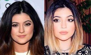 Kylie Jenner antes e depois.