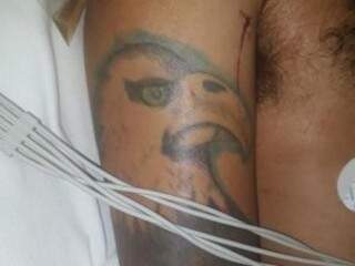 Tatuagem de águia em um dos braços da vítima. (Foto: Santa Casa/Divulgação)