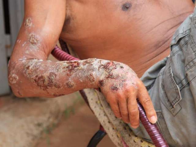 Morador abandonado e doente ser&aacute; levado para unidade de assist&ecirc;ncia social 