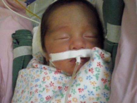 Beb&ecirc; sem intestino precisa de R$ 2 mi para fazer transplante nos EUA