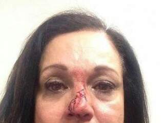 Foto foi tirada logo após mulher ser atingida pela lata de cerveja arremessada pelo empresário  (Foto: Reprodução/ Facebook)