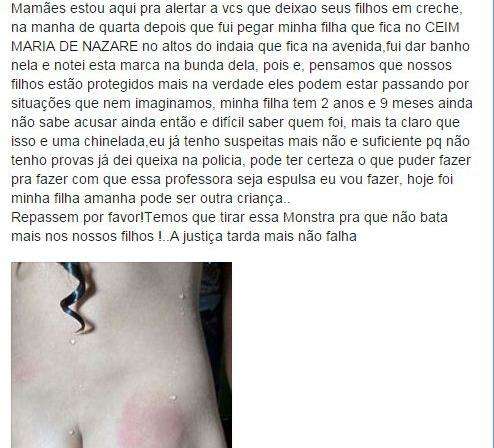 M&atilde;e acusa funcion&aacute;ria de Ceim de agredir crian&ccedil;a de dois anos