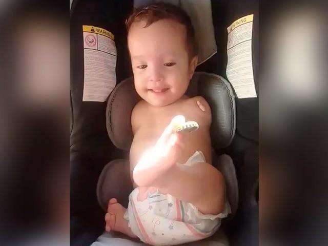 Com s&iacute;ndrome rara, beb&ecirc; precisa de apoio para custear medicamentos