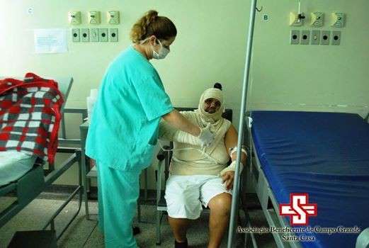Santa Casa realiza semana de Preven&ccedil;&atilde;o e Combate &agrave; Queimaduras