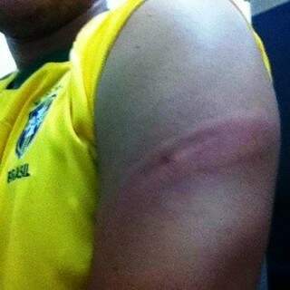 Estudante foi ferido no braço por cassetete (Foto: Divulgação)