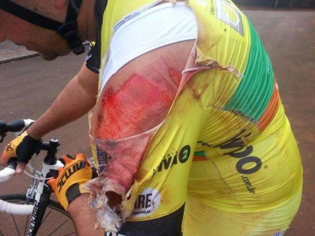 Ciclistas ficam feridos em acidente ao serem atingidos por botina