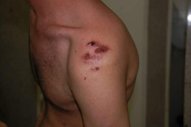  Homossexual, rapaz de 20 anos &eacute; agredido por grupo de jovens na Capital
