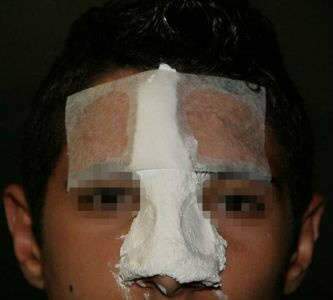  Militares do Ex&eacute;rcito s&atilde;o suspeitos de espacarem adolescente em Coxim