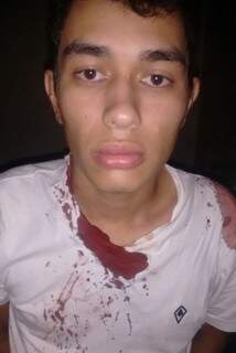 Cleberson Acosta levou tiro de raspão durante perseguição (Foto: Divulgação/DOF)