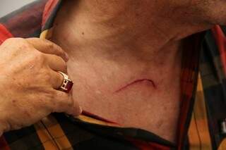 Vítima mostra pequeno ferimento causado pelo canivete utilizado pelos bandidos. (Foto: Marcos Ermínio)