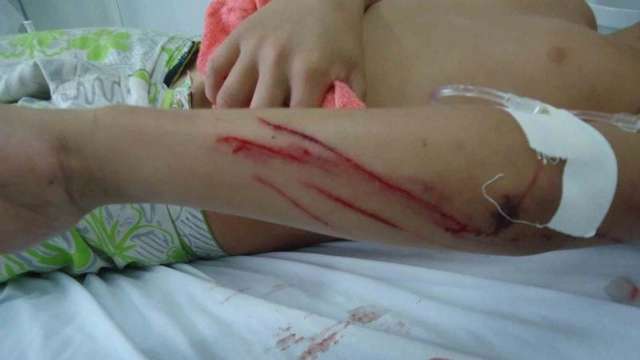 Garoto de 10 anos &eacute; ferido com facada no bra&ccedil;o pelo pai