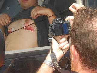 Motorista mostra marca de tiro no peito. (Foto: Simão Nogueira)