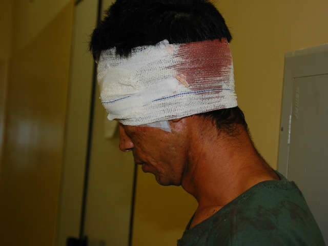  Comando diz que PM foi agredido por grupo antes de balear 5 no Pioneiros