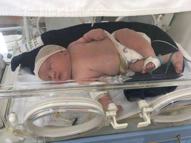 Com 54 cm e quase 6 quilos, Rafael bate recordes em hospital na Fronteira