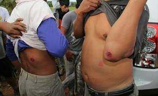 De acordo com MPF, índios feridos por balas de borracha. (Foto: Divulgação)