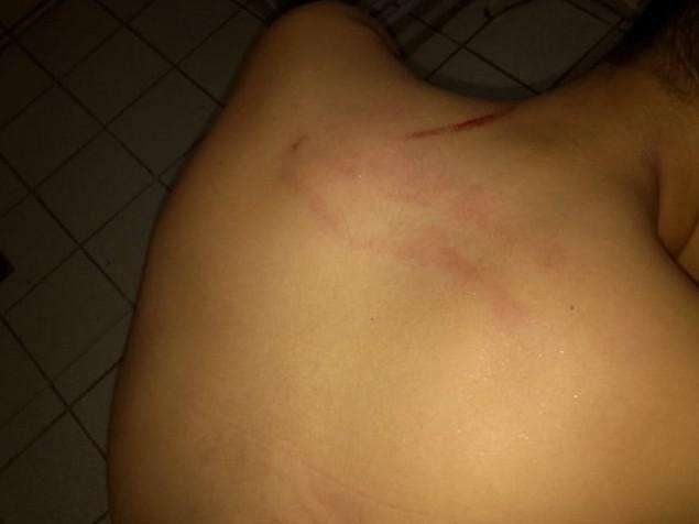 &ldquo;Estourou por dentro&rdquo;, afirma m&atilde;e de garoto espancado por policial militar