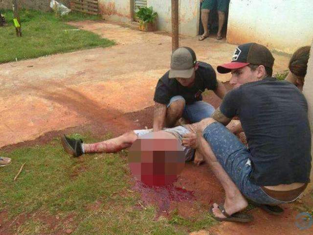 Homem tem perna decepada ao ser atingido por carro em cruzamento