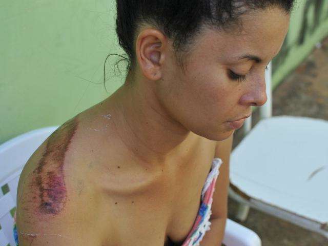 &ldquo;Ciumento e desconfiado&rdquo;, diz mulher atropelada pelo ex-marido