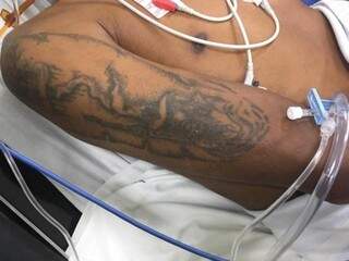 Tatuagem em um dos braços de Alex, identificado por familiares (Foto: Divulgação/ Santa Casa)