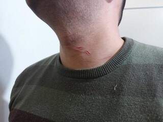 Caminhoneiro mostra cortes no pescoço provocados por assaltante (Foto: Divulgação)