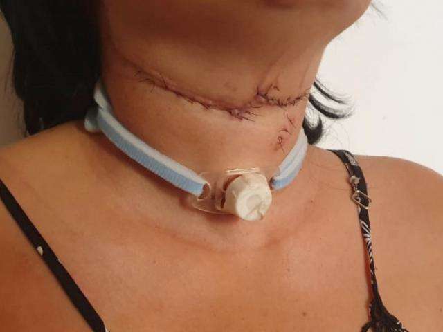 Depois de 11 facadas, mulher de 30 anos comemora a vida em casa