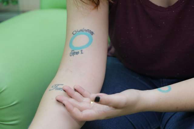 Depois de erro em hospital, Anna tatuou a diabetes tipo 1 nos dois bra&ccedil;os 