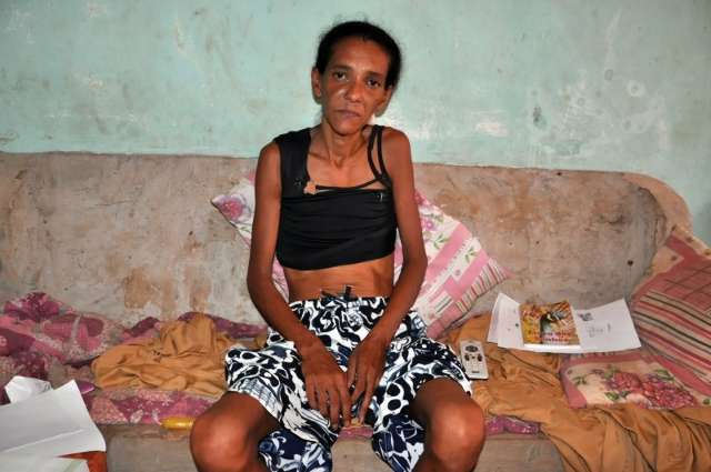 Com 26 quilos, mulher definha e implora por tratamento contra c&acirc;ncer